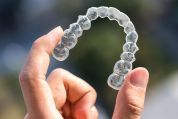 Clear braces in Essex